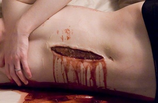 Gut
