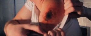 The Ballad of Skinless Pete