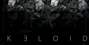 Keloid