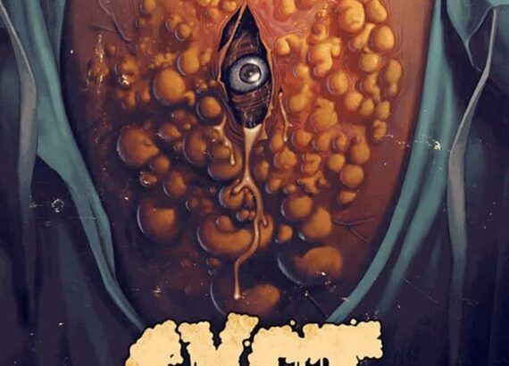 Cyst (Tyler Russell)
