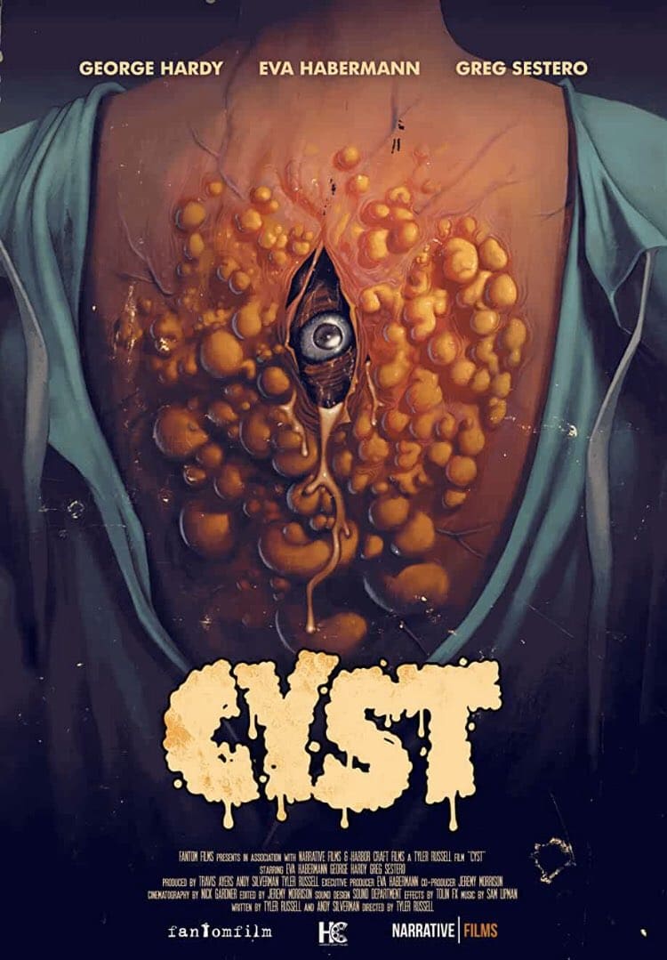 Cyst (Tyler Russell)