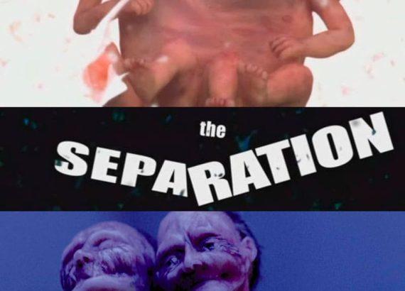 The Separation (Robert Morgan)